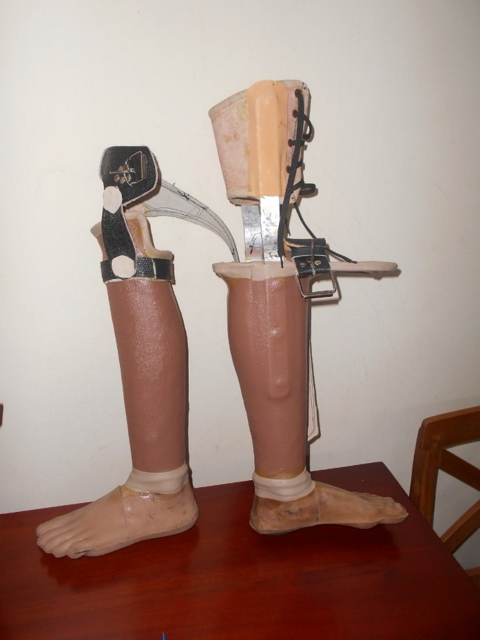 Donation of artificial limbs